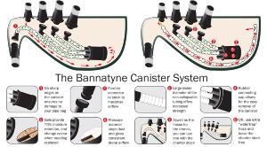 Bannatyne Bagpipe Moisture Control System - Bagpipes Galore